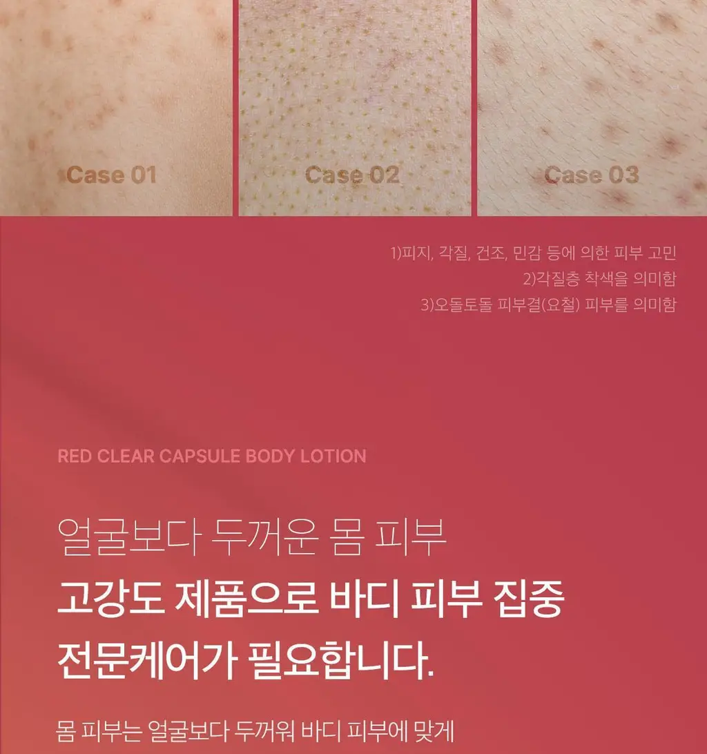 [NEW/바디트러블 케어] 메디큐브 레드 클리어 캡슐 바디로션 230ml 상세페이지 11